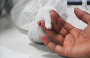 Julho Amarelo: em Feira 1.588 pacientes são acompanhados no programa municipal